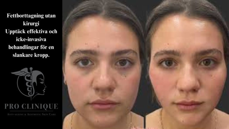 Fettborttagning utan kirurgi Upptäck effektiva och icke-invasiva behandlingar för en slankare kropp.